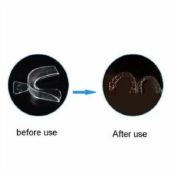 THSINDE 4 X Mundschienen Für Zahnaufhellung / Gel-Bleichmittel, Thermoformbarer Zahnfleischschutz -Angebote Fliesenleger-Werkzeug Store 55256428 3